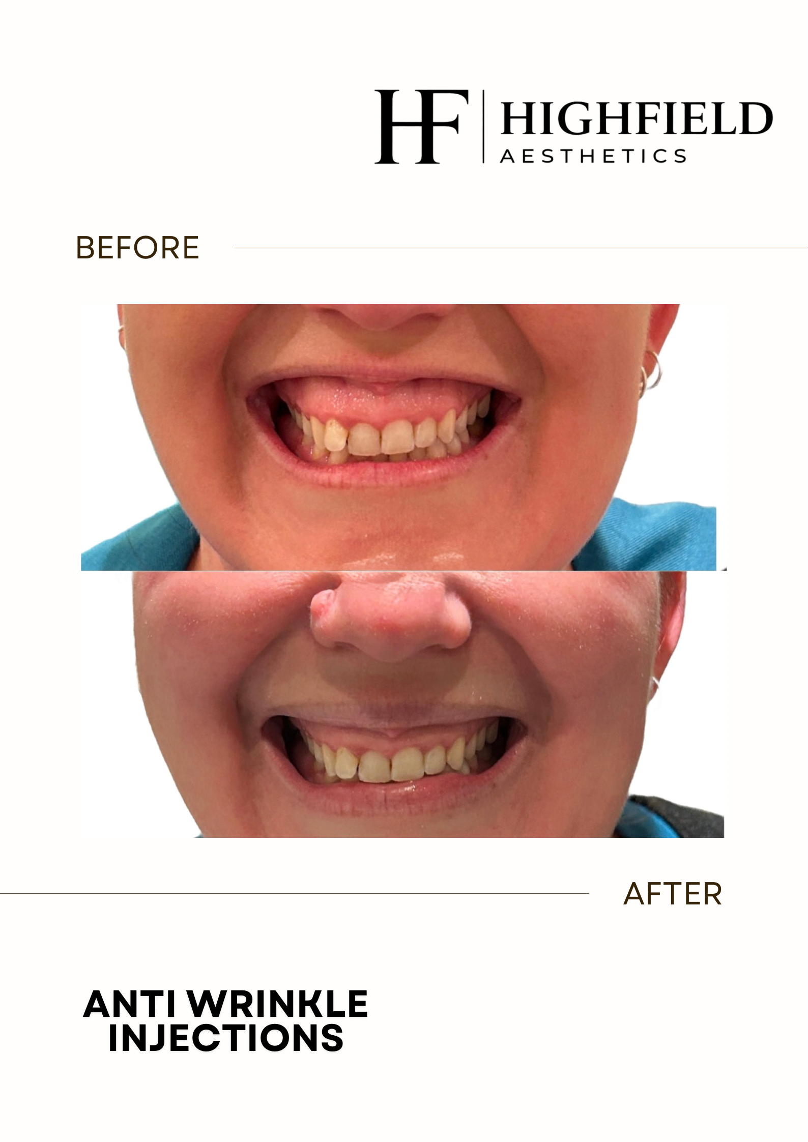 Before-and-after result: anti-wrinkle-01.png