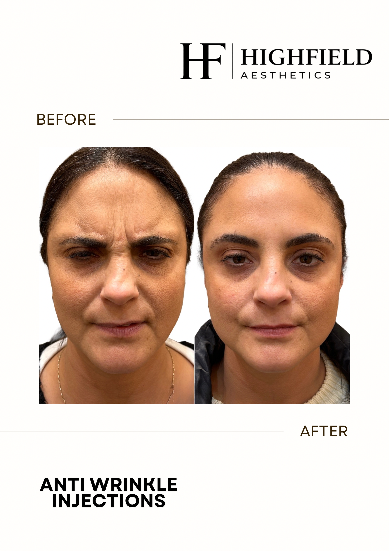 Before-and-after result: anti-wrinkle-02.png