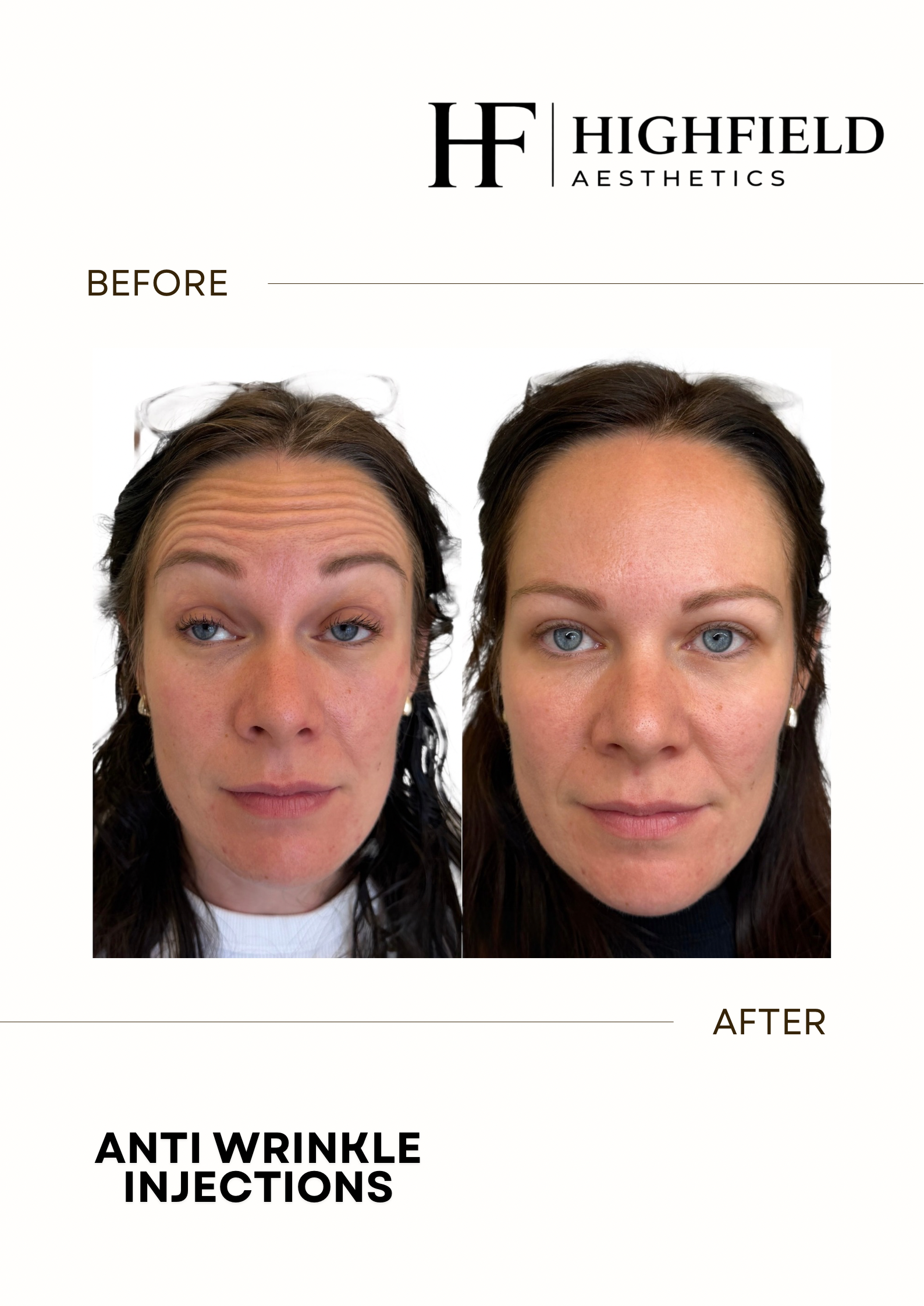 Before-and-after result: anti-wrinkle-03.png