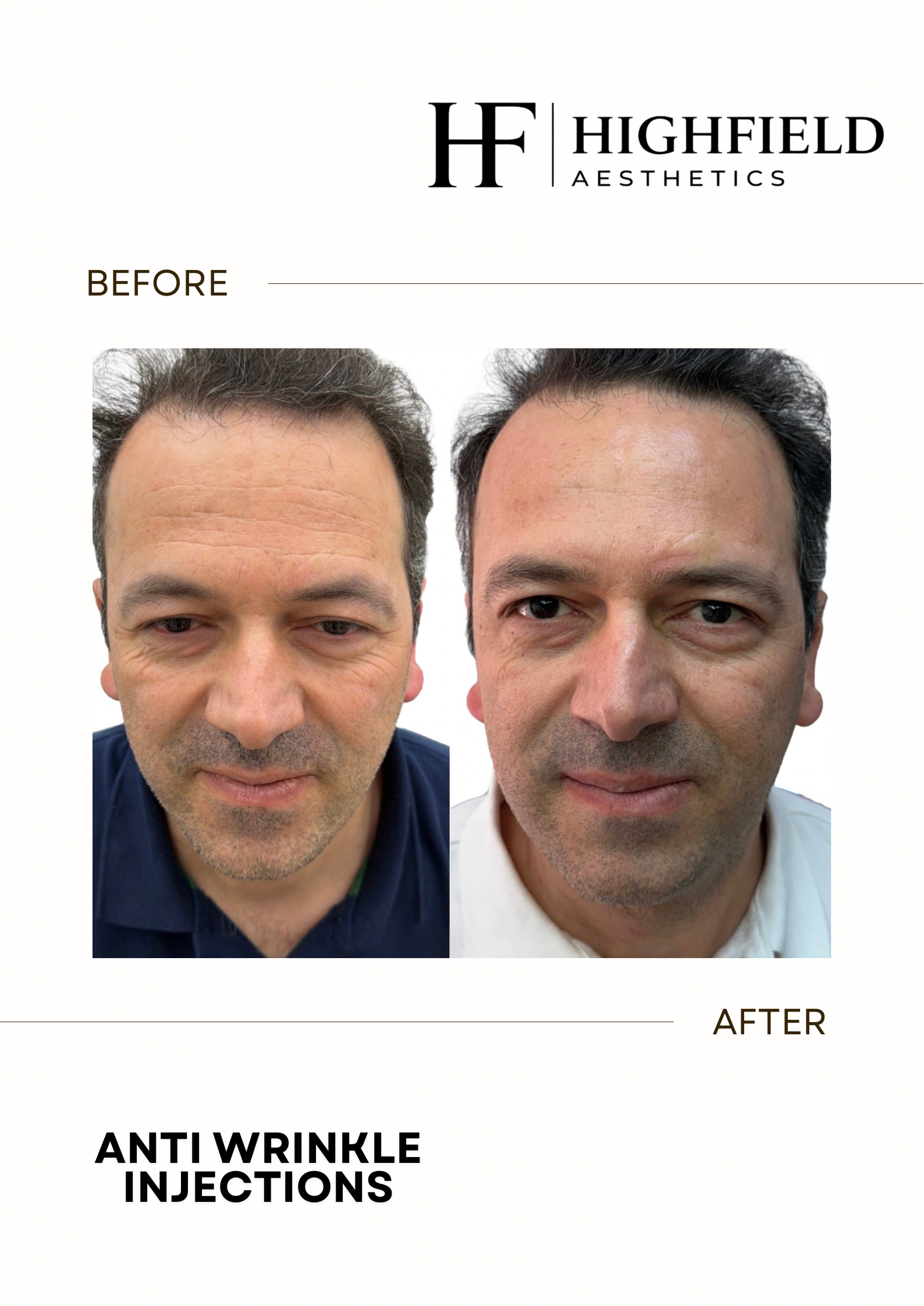 Before-and-after result: anti-wrinkle-04.png