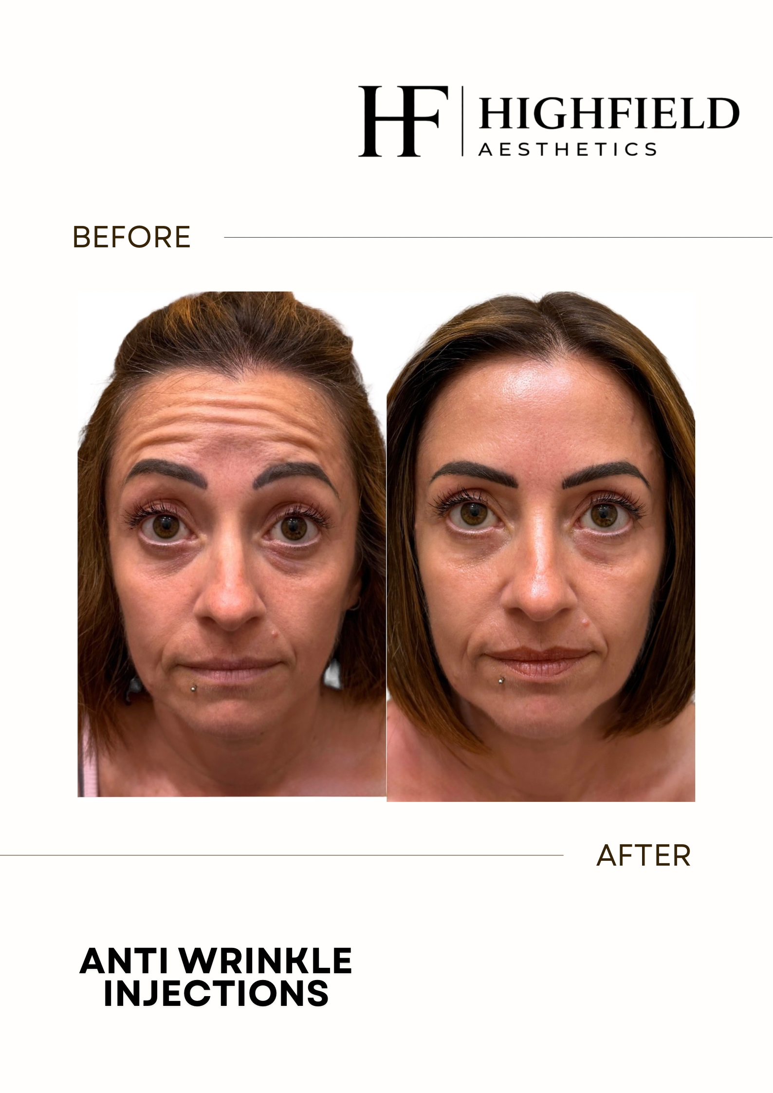 Before-and-after result: anti-wrinkle-05.png