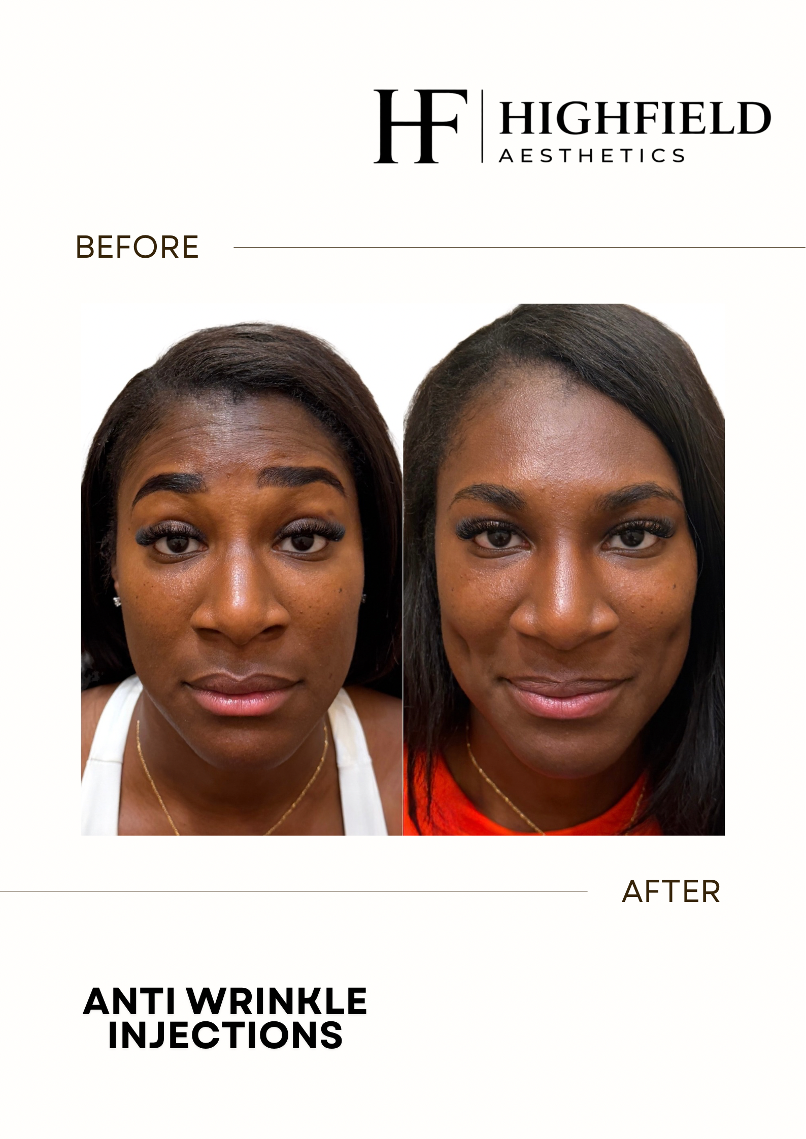 Before-and-after result: anti-wrinkle-06.png