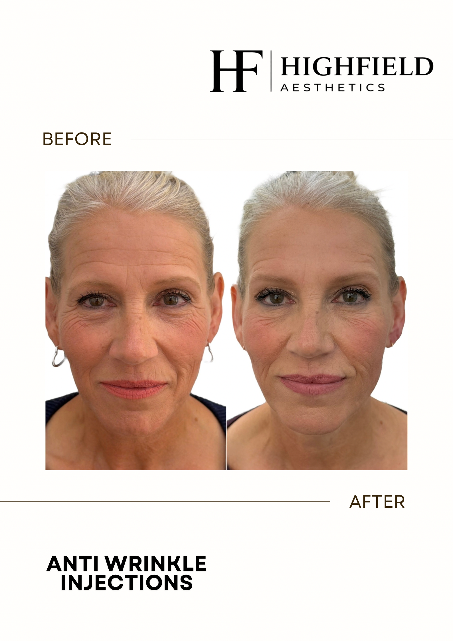 Before-and-after result: anti-wrinkle-07.png