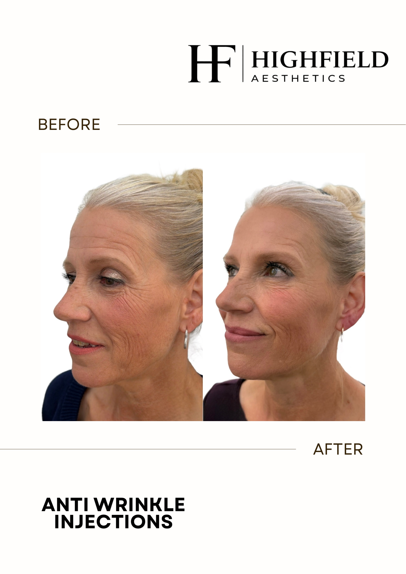 Before-and-after result: anti-wrinkle-08.png
