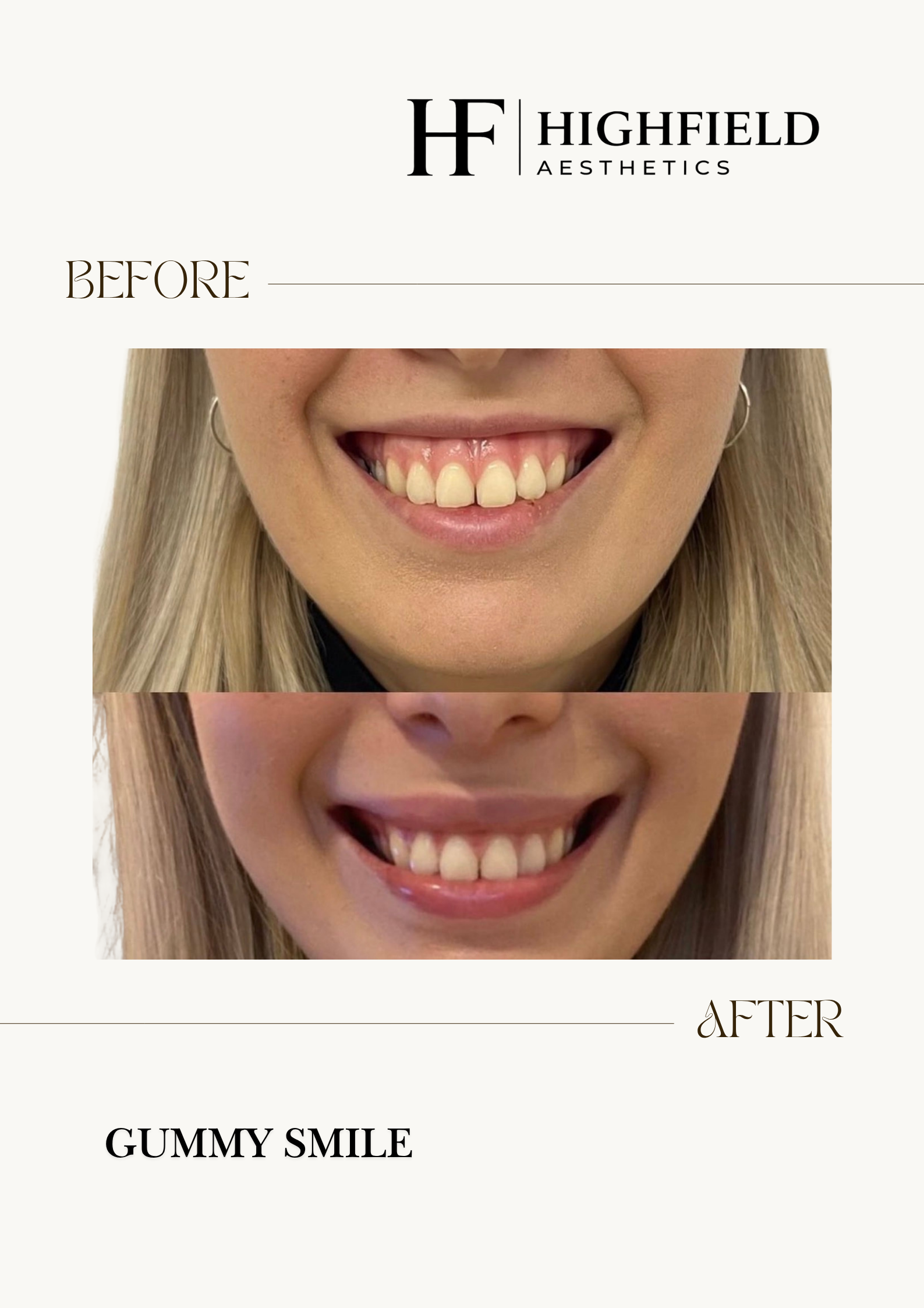 Before-and-after result: anti-wrinkle-img-4189.png
