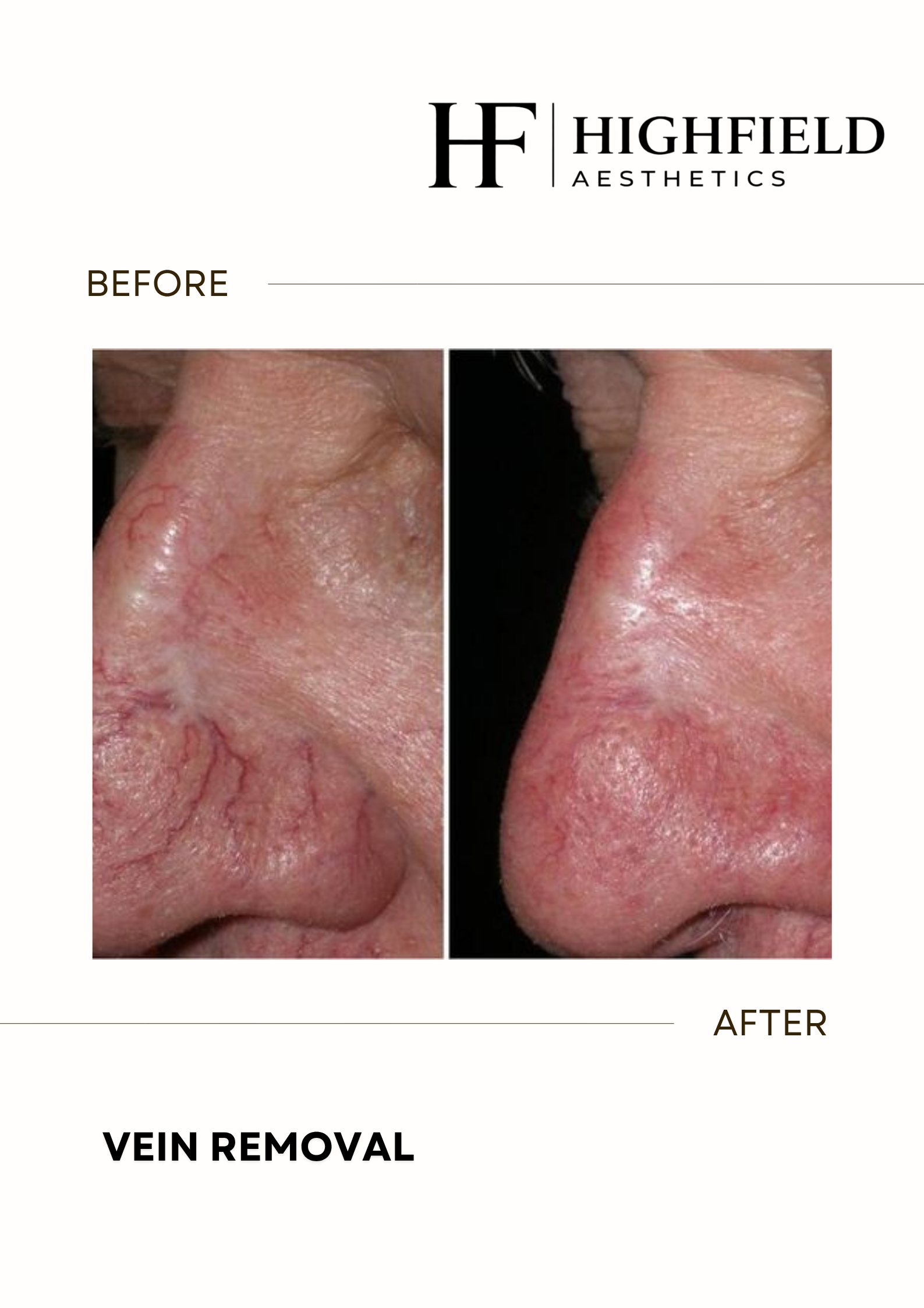Before-and-after result: candela-skin-23.png