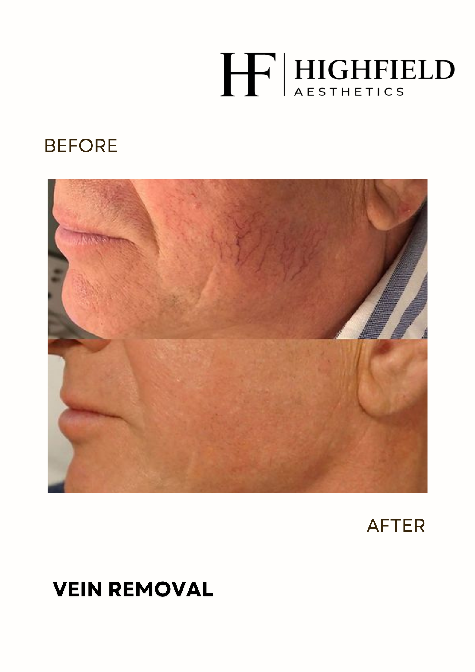 Before-and-after result: candela-skin-24.png