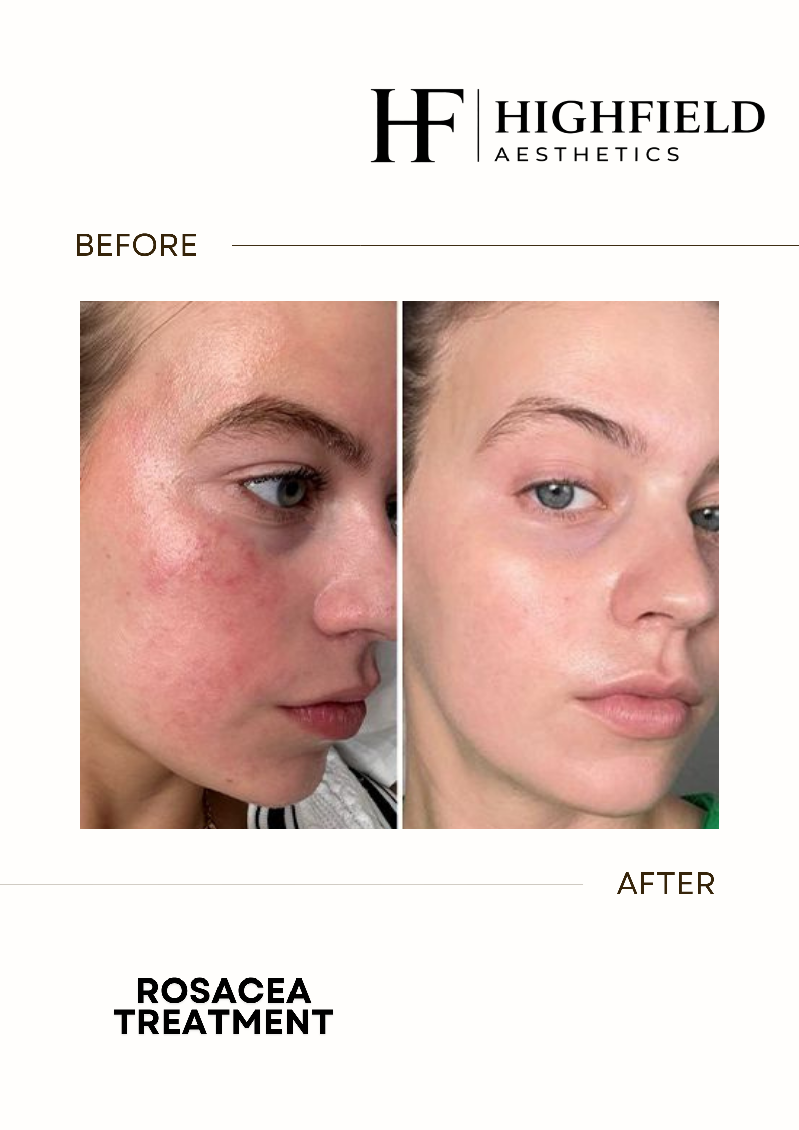 Before-and-after result: candela-skin-25.png
