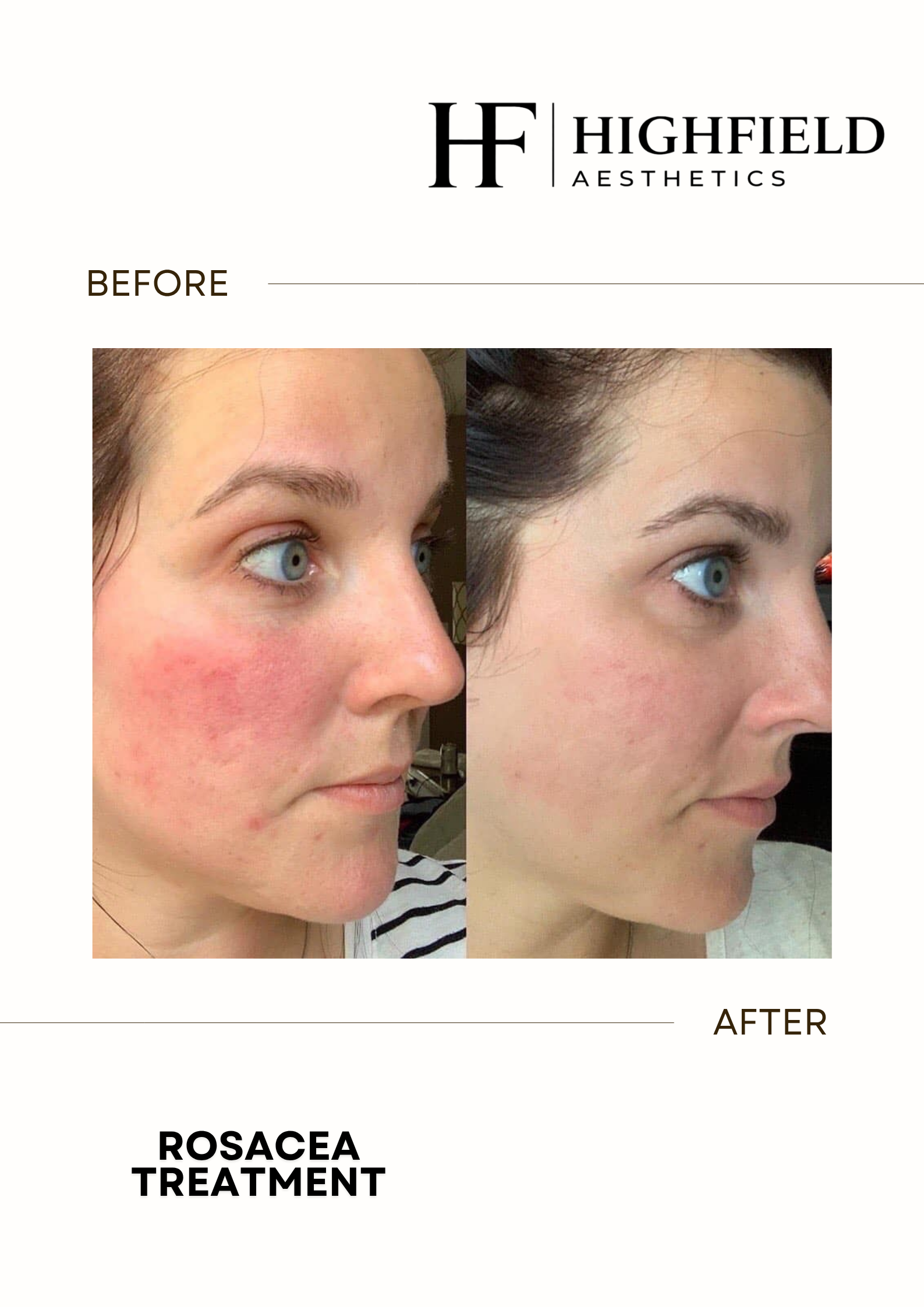 Before-and-after result: candela-skin-26.png