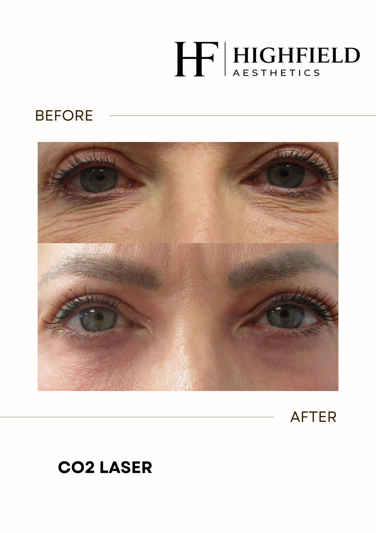 Before-and-after result: co2-laser-18.png