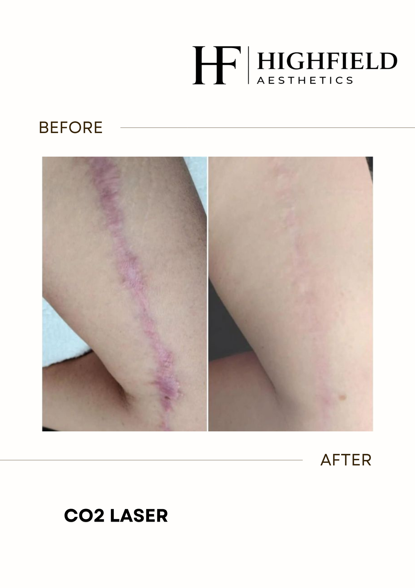 Before-and-after result: co2-laser-19.png