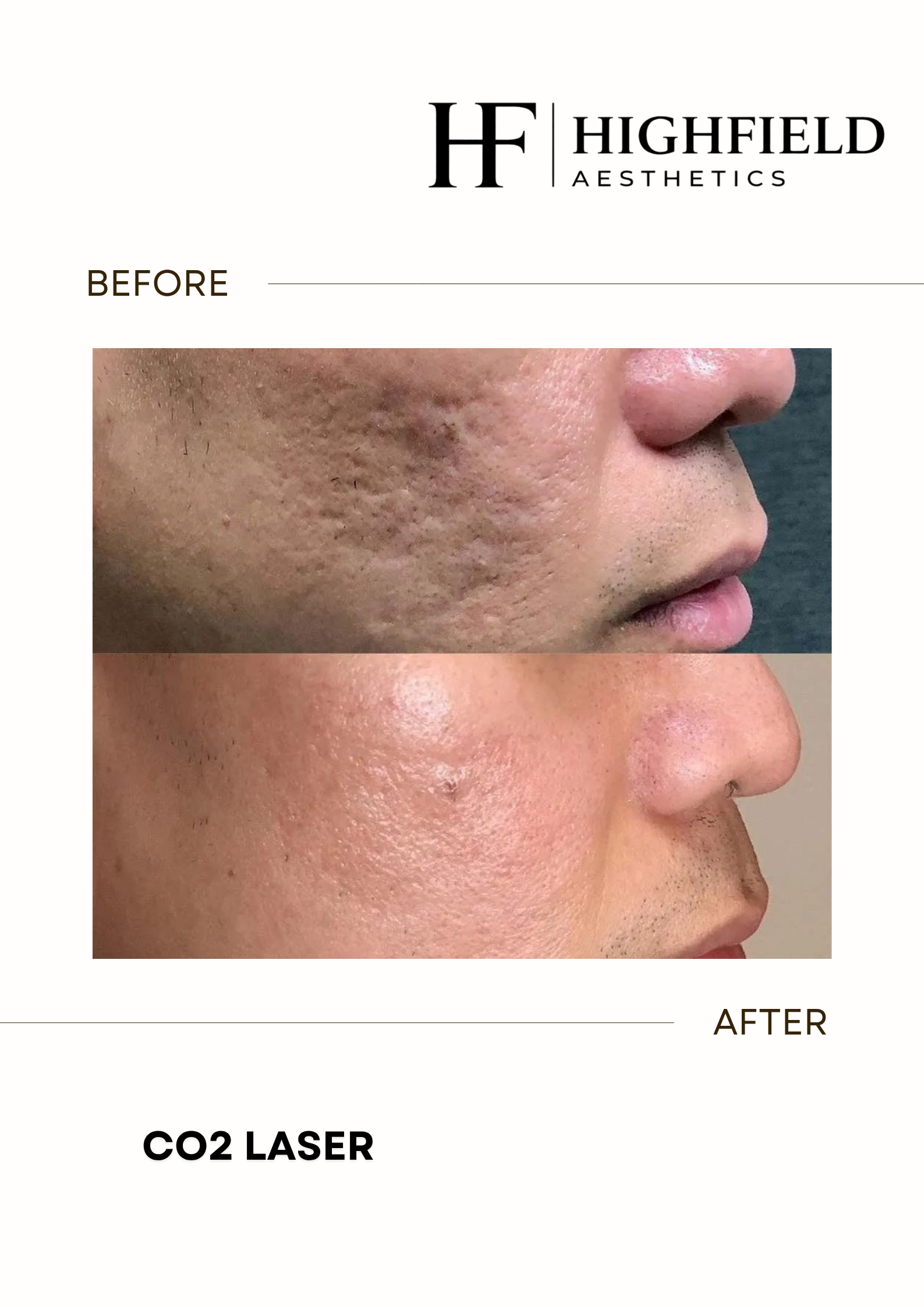 Before-and-after result: co2-laser-20.png