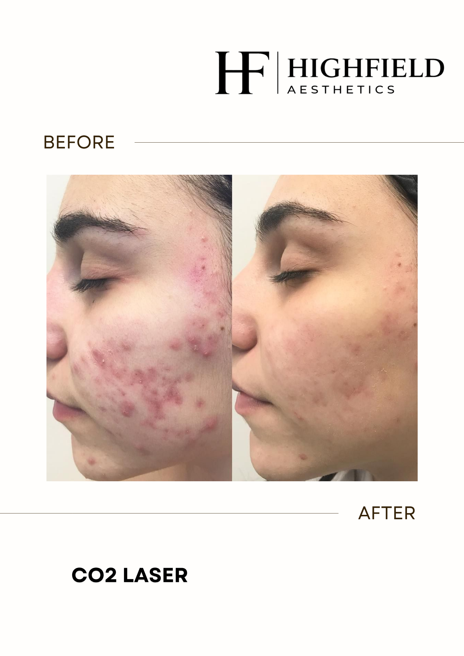 Before-and-after result: co2-laser-21.png