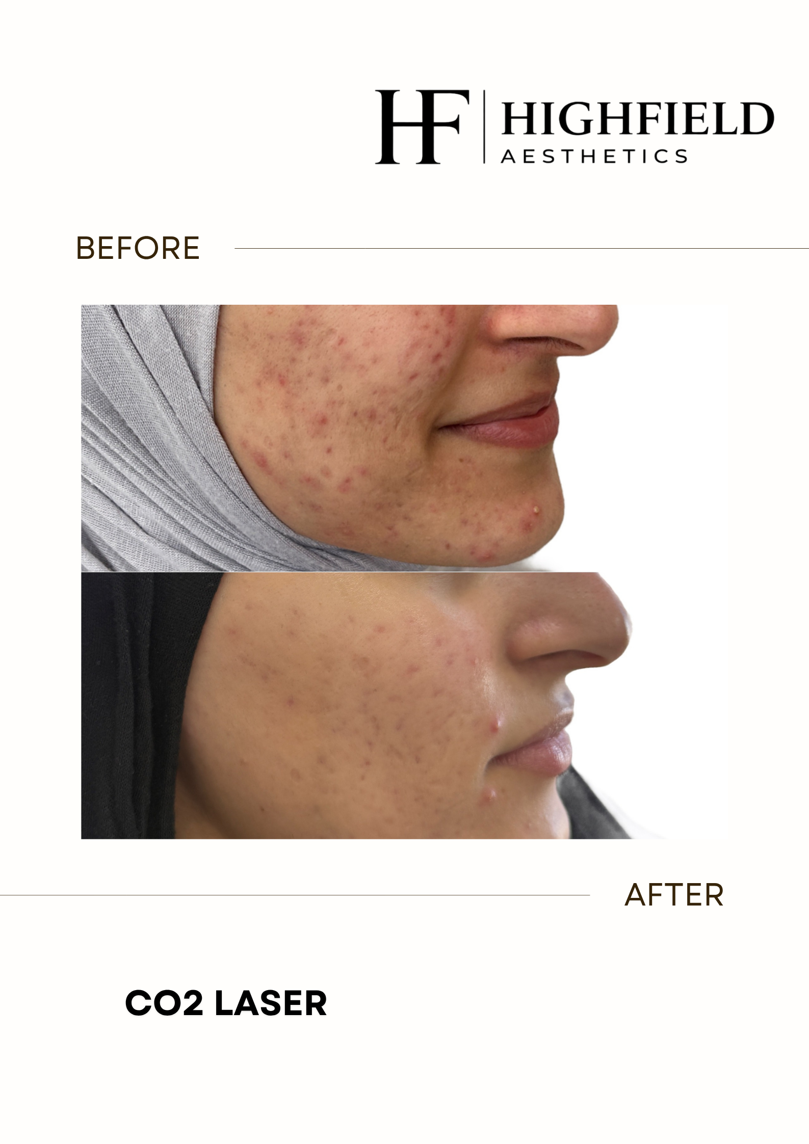 Before-and-after result: co2-laser-22.png