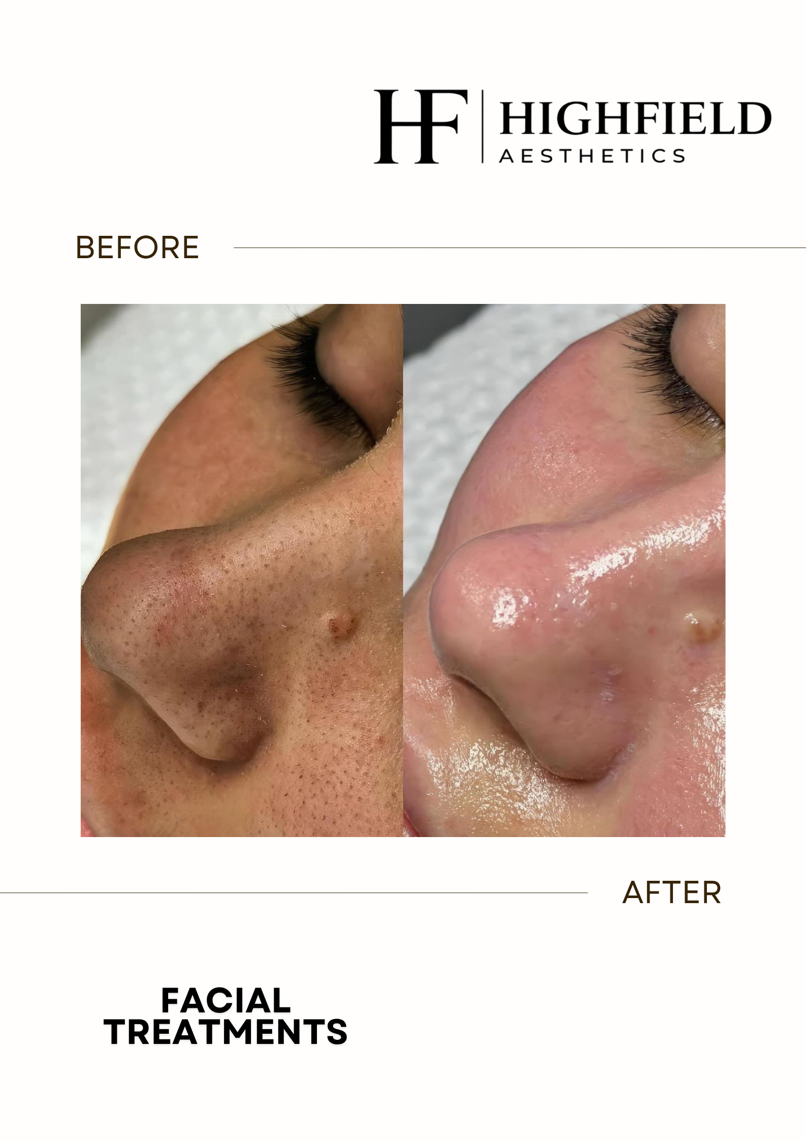 Before-and-after result: facial-34.png