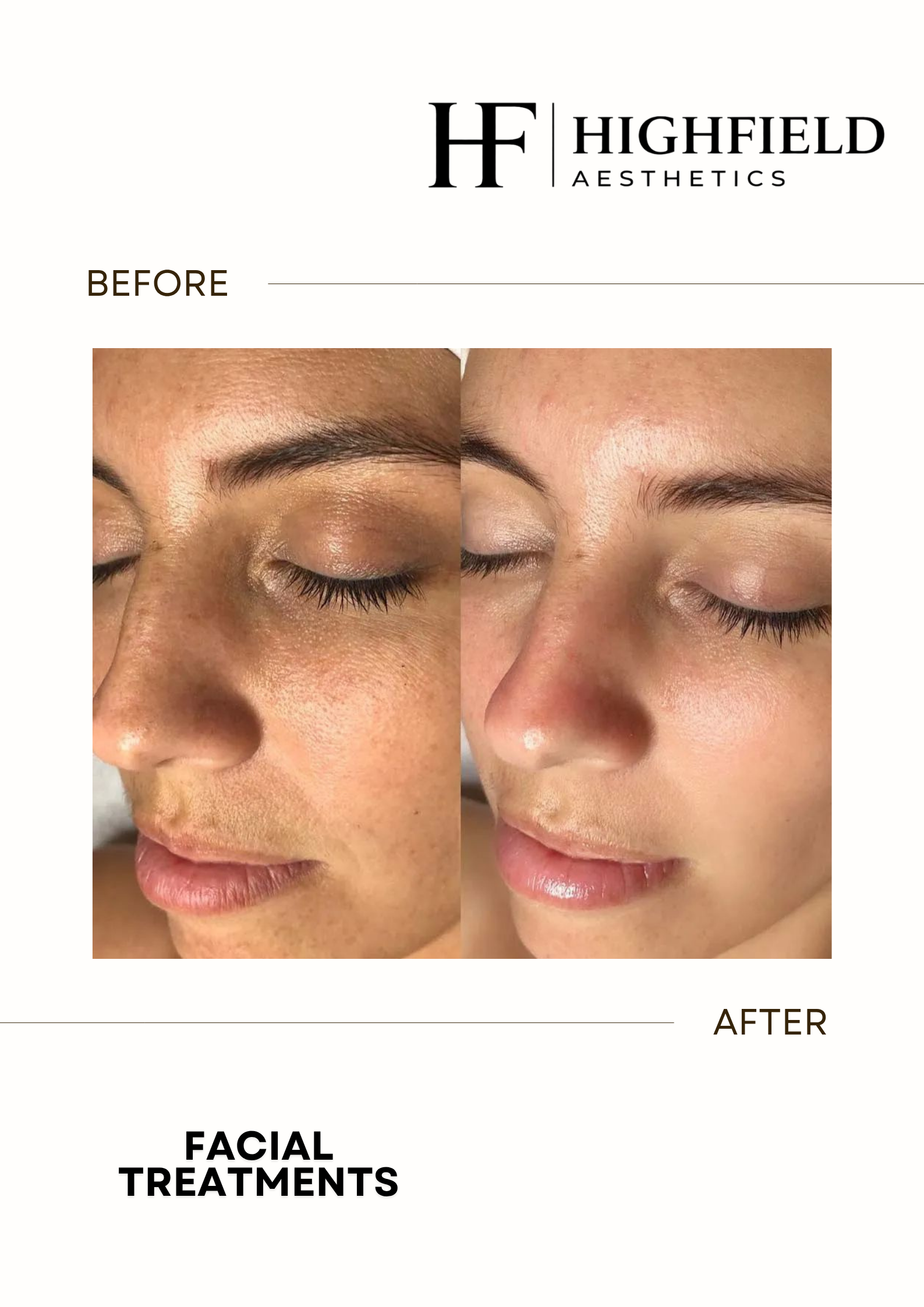 Before-and-after result: facial-35.png