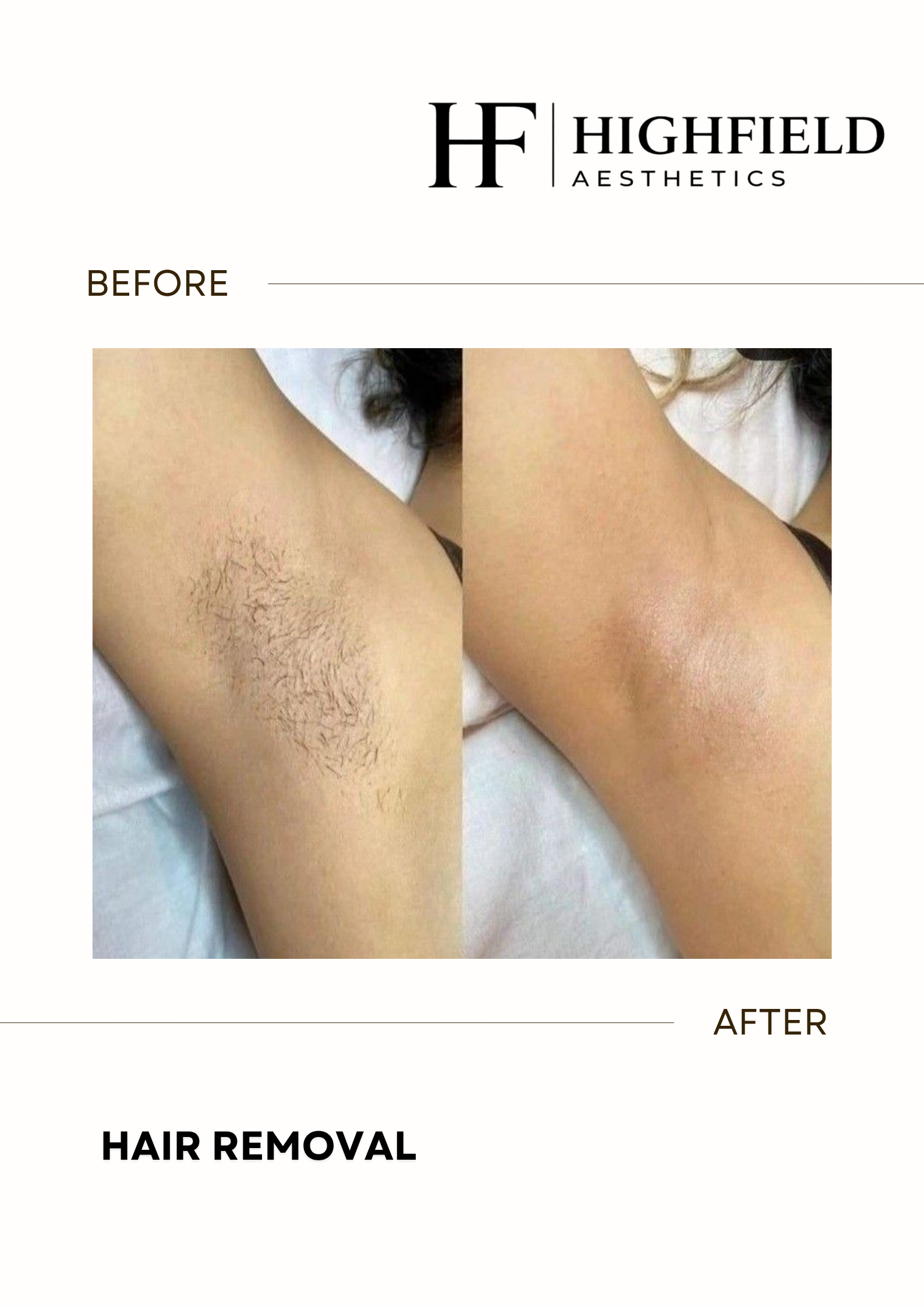 Before-and-after result: hair-removal-27.png