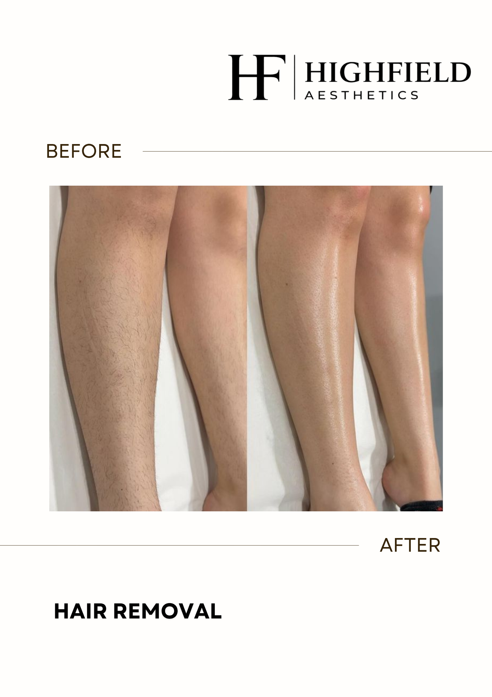 Before-and-after result: hair-removal-28.png
