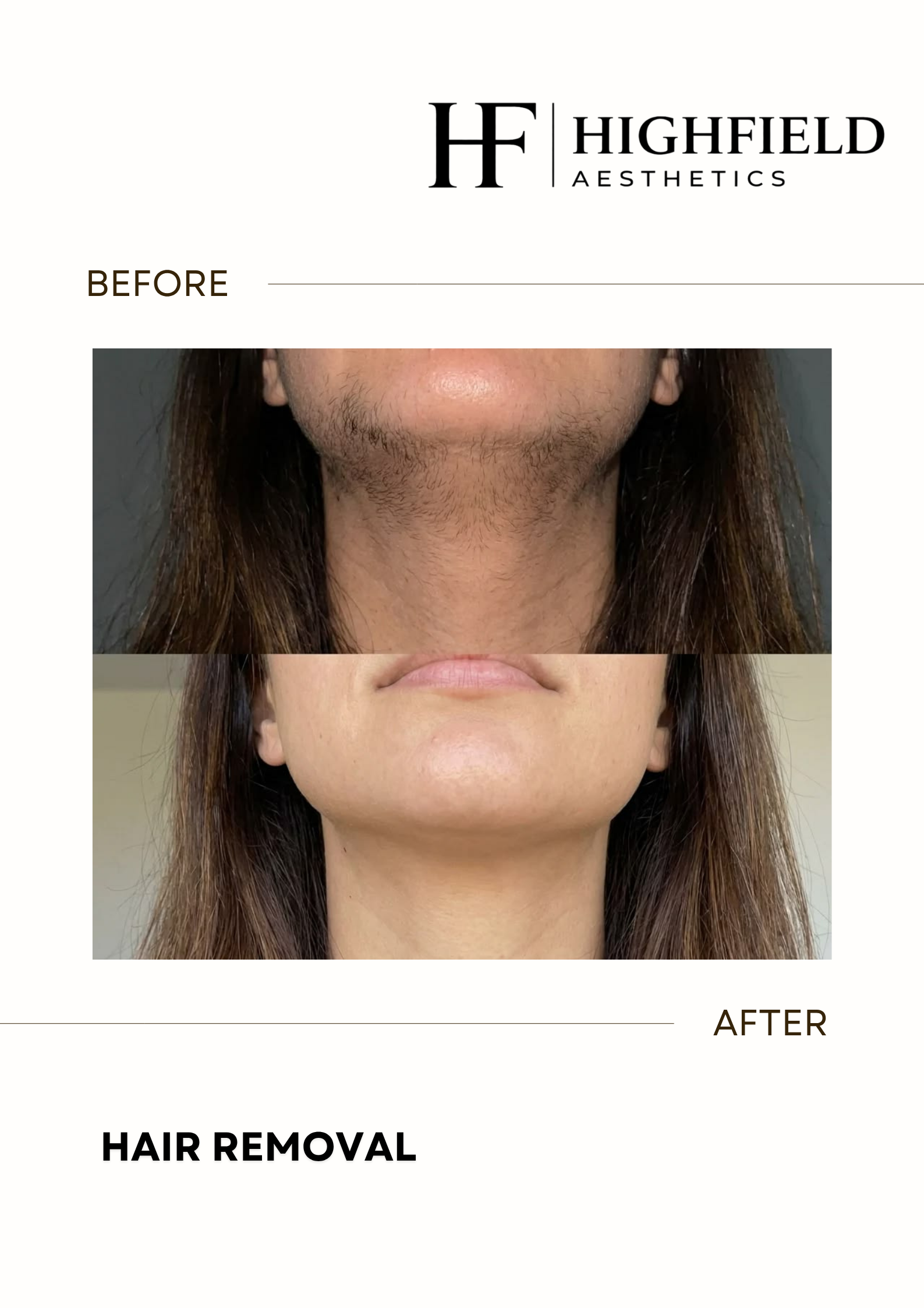 Before-and-after result: hair-removal-30.png