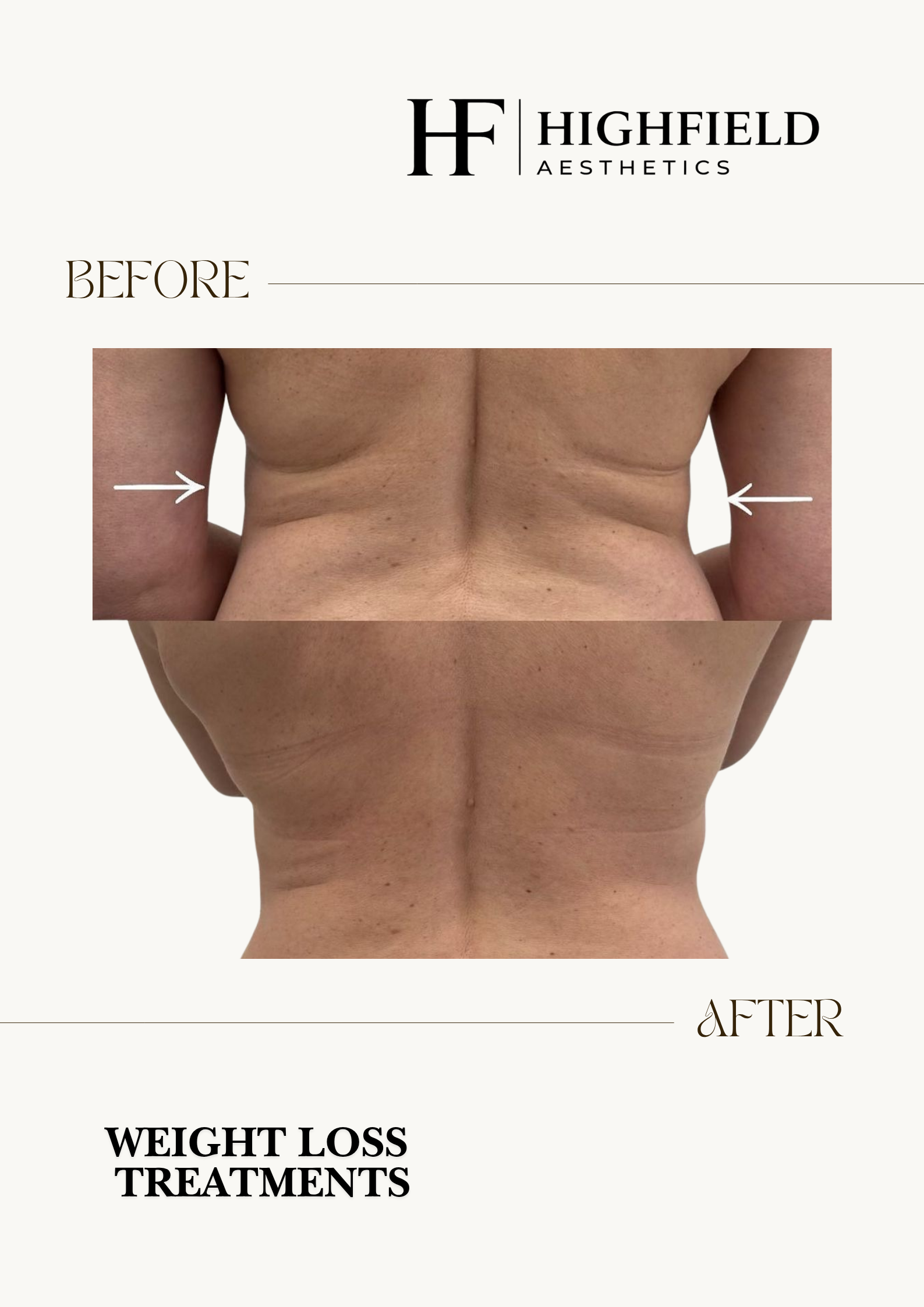 Before and after: Weight-management example. Before above, after below.