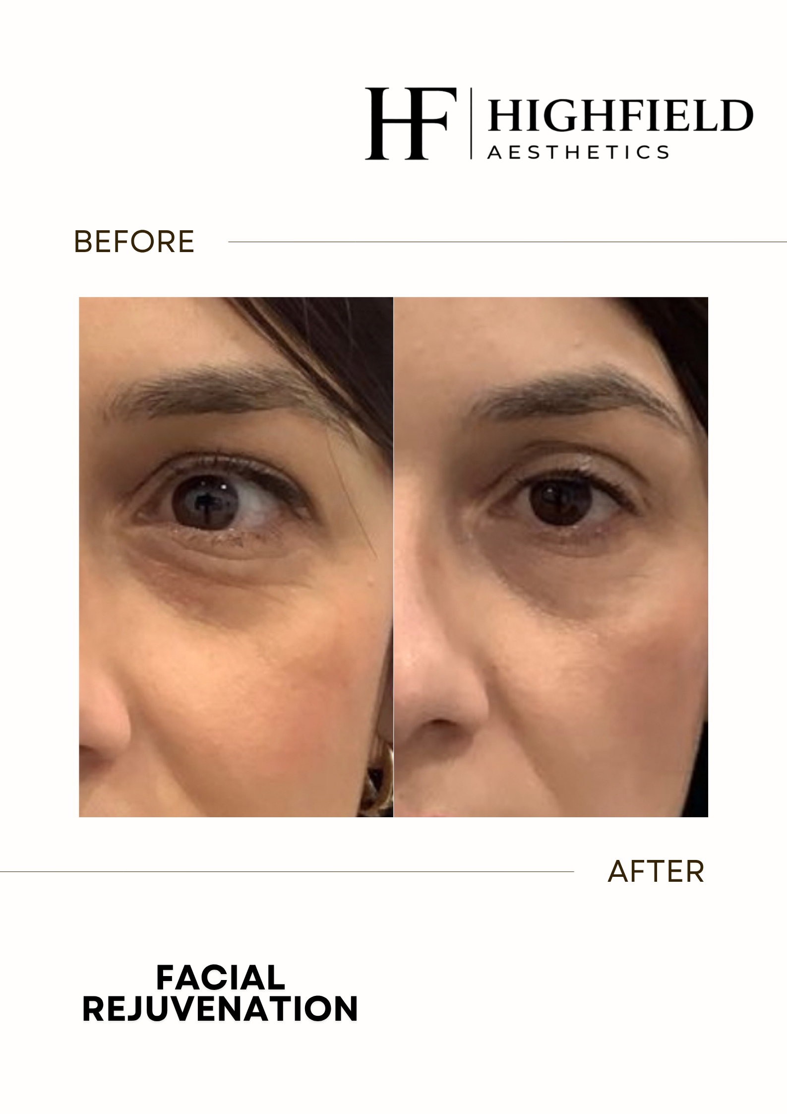 Before-and-after result: skin-rejuvenation-08.png