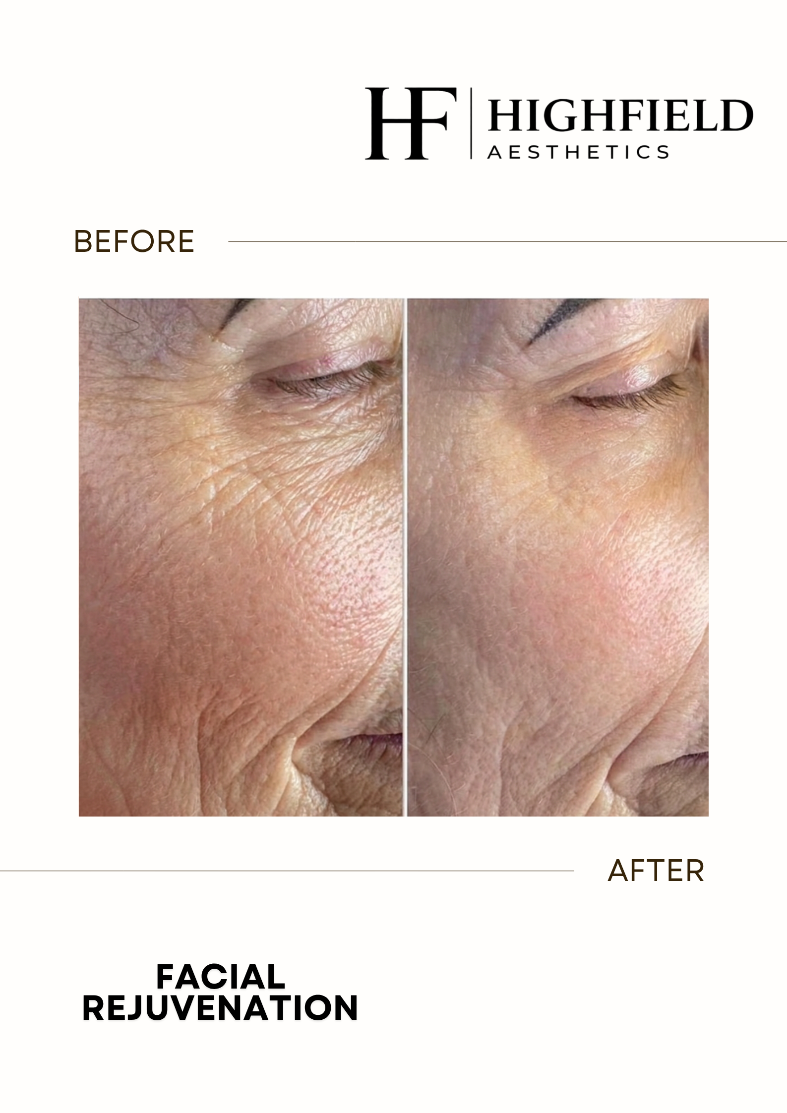 Before-and-after result: skin-rejuvenation-09.png
