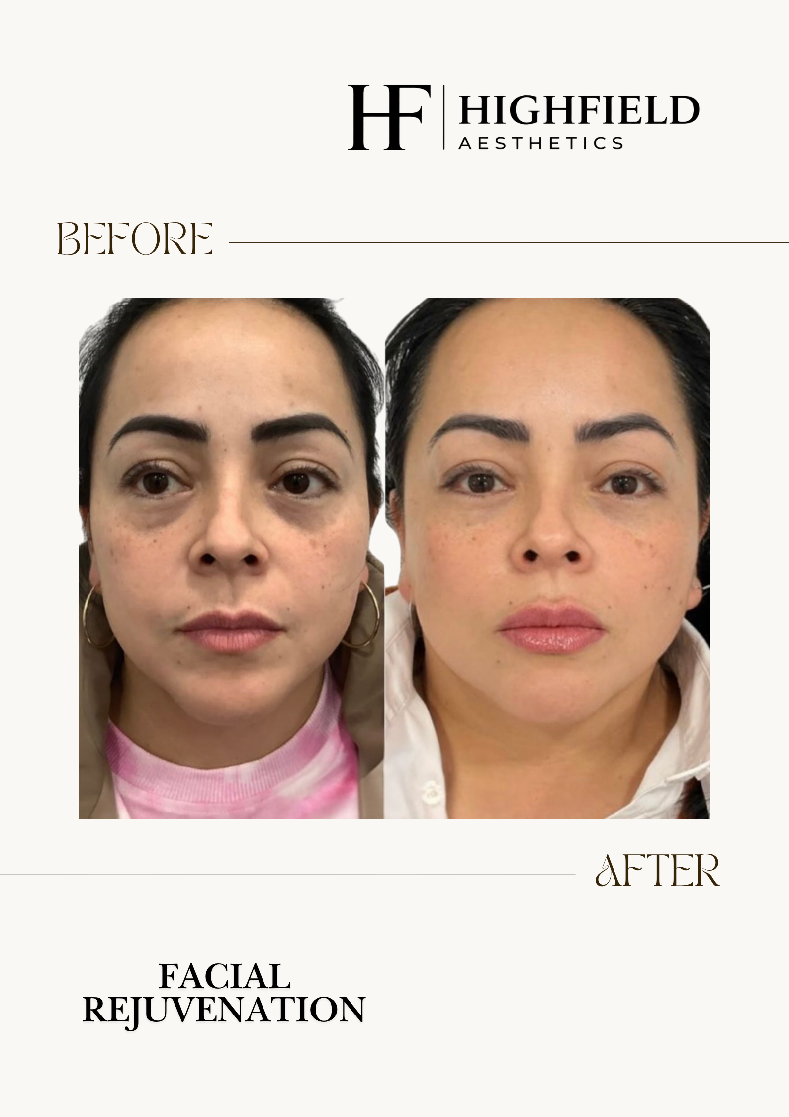 Before-and-after result: skin-rejuvenation-img-4186.png